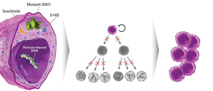 IDH1 mutations block normal differentiation of myeloblasts superscript 5
