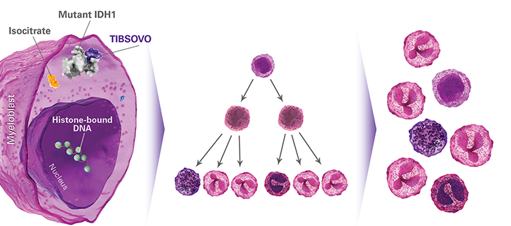 IDH1 mutations block normal differentiation of myeloblasts superscript 5